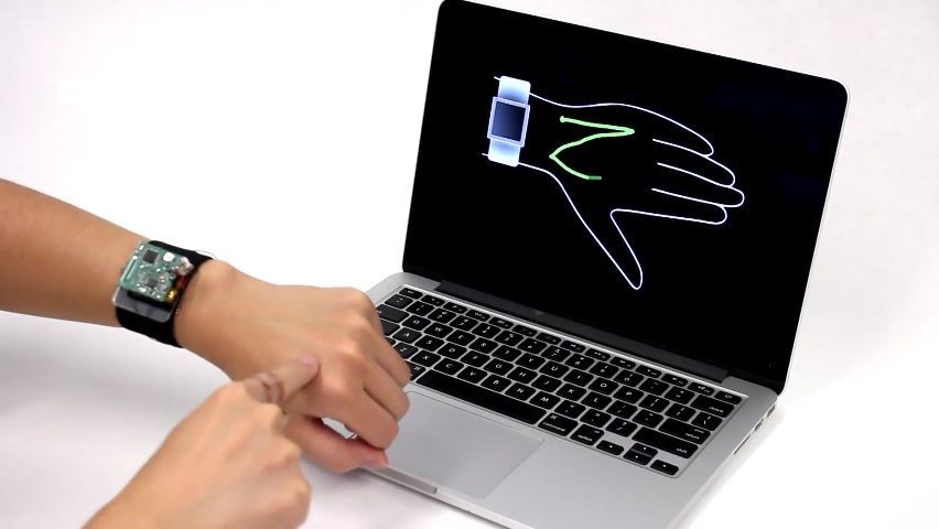 skintrack